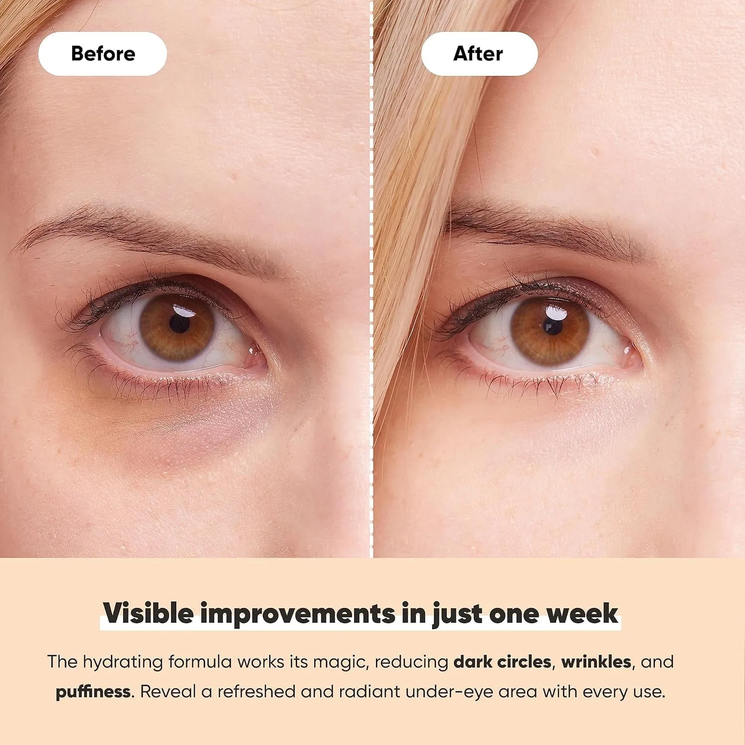 under Eye Patches - Gold under Eye Masks for Dark Circles and Puffiness - with Collagen & Amino Acids - Gifts for Women - Bridesmaid Gifts (20 Pairs)